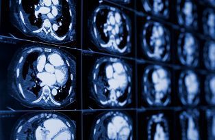 understanding brain injuries in kentucky
