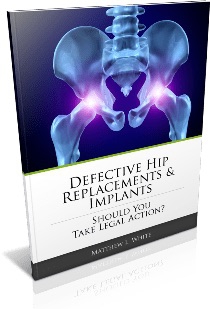 Free Guide to Defective Hip Replacement Lawsuits