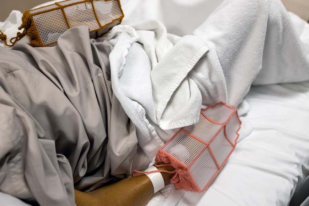A hospitalized patient lying in bed with protective mesh coverings on their hands, illustrating hospital delirium prevention and patient safety care.