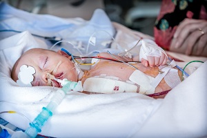 An infant is treated in the hospital for meningitis
