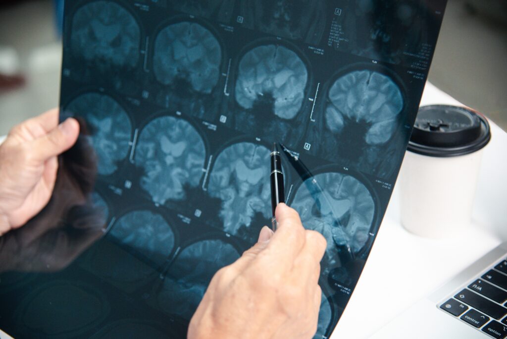 HIE Diagnosis