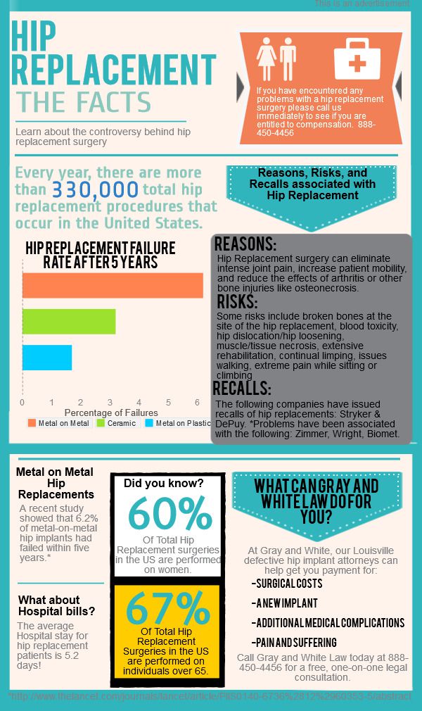 Hip Recall Infographic