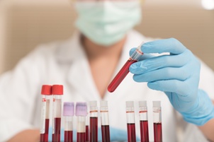 Lab technician with vials of blood samples sepsis testing