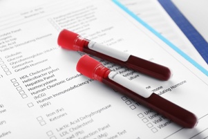 blood sample tubes on blood test form