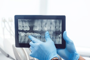 dentist examining an xray of teeth Gray & White