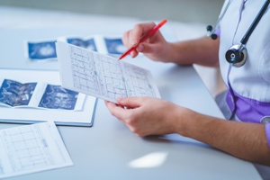 doctor checking electrocardiogram and other medical tests