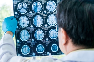 doctor examining brain scans MRI brain injury