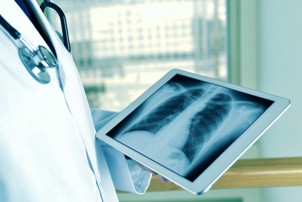 doctor looking at x-ray of chest and lungs