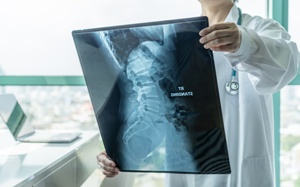 doctor looking at xray of spinal cord