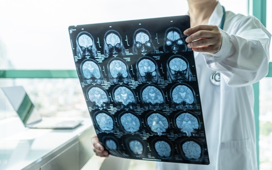 doctor examining brain scans