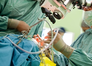 doctors performing brain surgery