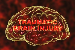 image of brain with the words traumatic brain injury