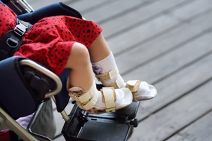 legs of child with cerebral palsy in wheelchair