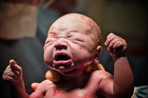 A newborn may suffer broken bones due to medical staff negligence during birth