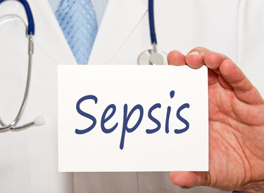 ultimate guide to sepsis Kentucky
