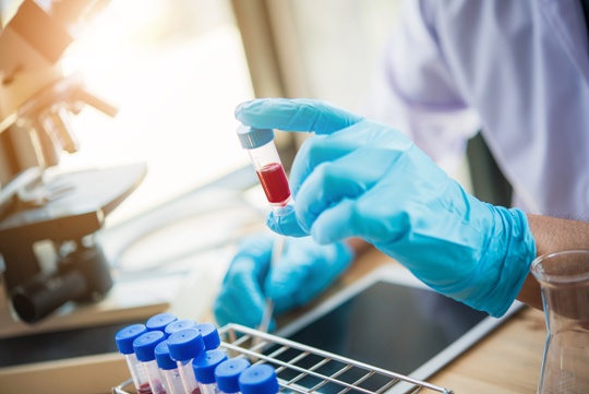 Louisville nursing homes screening for sepsis in Kentucky